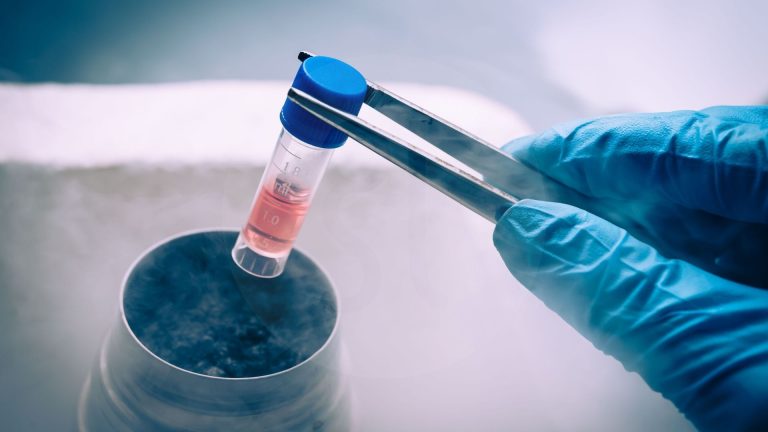 Frozen Embryo Transfer FET