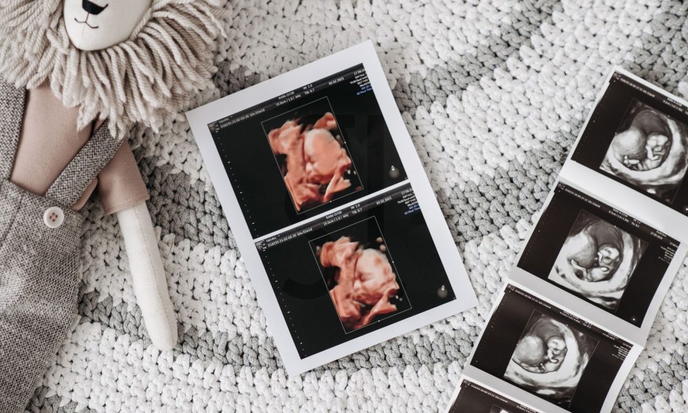 cyprus ivf