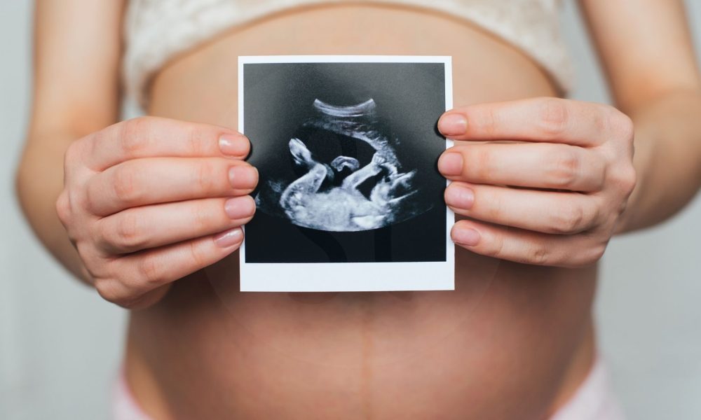 fertility cyprus