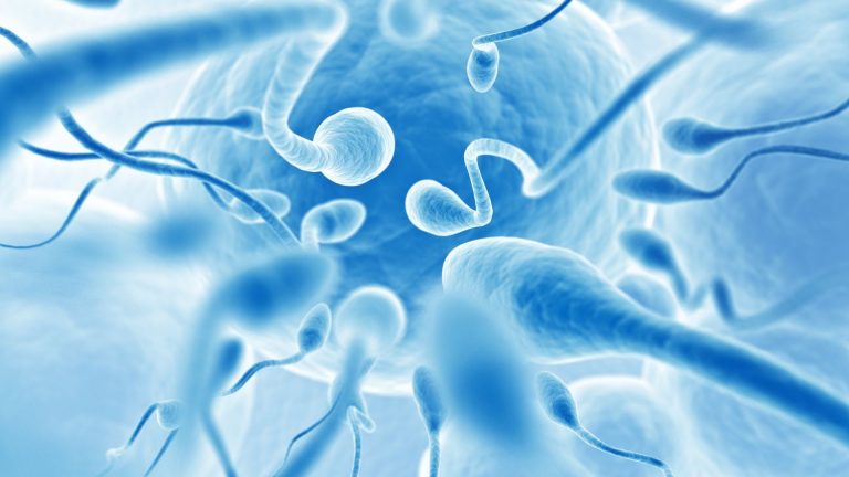 sperm donation