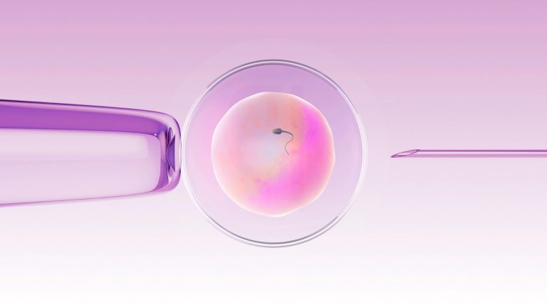 أطفال الأنابيب المزدوج (Tandem IVF)